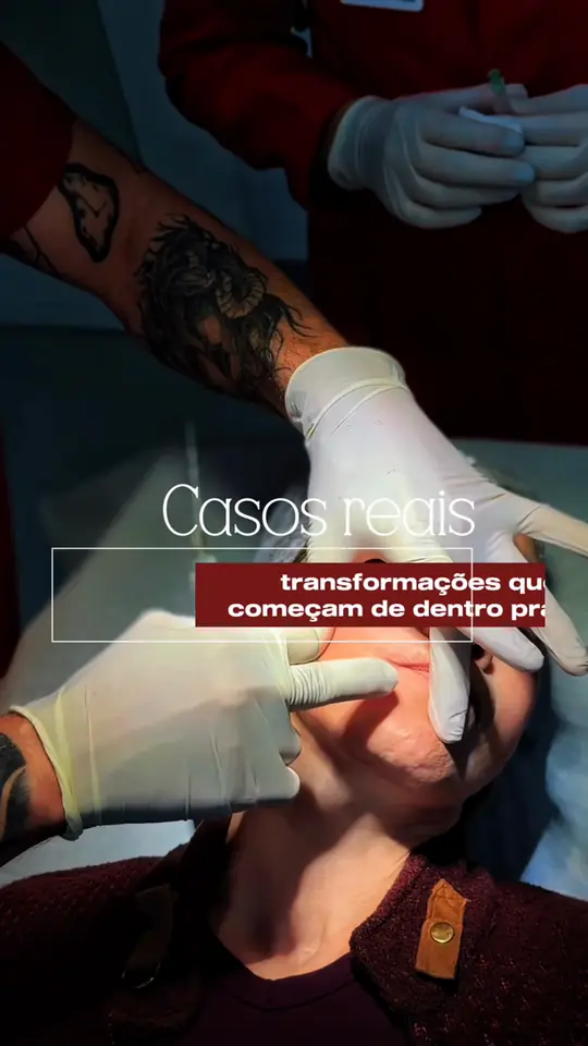 Vídeo de procedimento estético com registro de casos reais